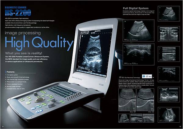 腹部超音波、頭頸部超音波、婦科陰道超音波、肌肉骨骼超音波、甲狀線超音波、攜帶型超音波、手提式超音波、Toshiba 腹部超音波、頭頸部超音波、婦科陰道超音波、肌肉骨骼超音波、甲狀線超音波、攜帶型超音波、手提式超音波、Toshiba