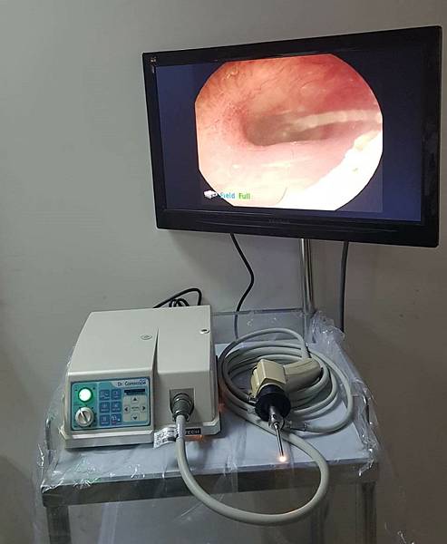 耳鼻喉科內視鏡 耳鼻喉科內視鏡