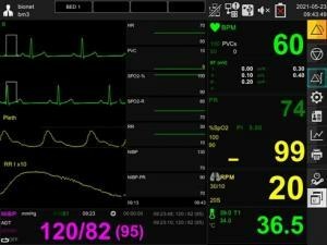 Bionet BM3血壓、血氧、心電圖三合一生理監視器 Bionet BM3血壓、血氧、心電圖三合一生理監視器