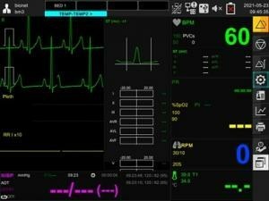 Bionet BM3血壓、血氧、心電圖三合一生理監視器 Bionet BM3血壓、血氧、心電圖三合一生理監視器