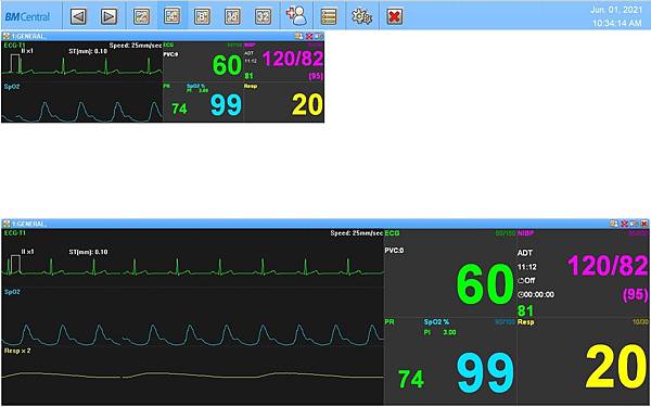Bionet BM3血壓、血氧、心電圖三合一生理監視器 Bionet BM3血壓、血氧、心電圖三合一生理監視器