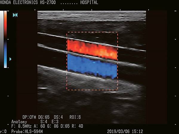 杜普勒動物用彩色超音波 杜普勒動物用彩色超音波