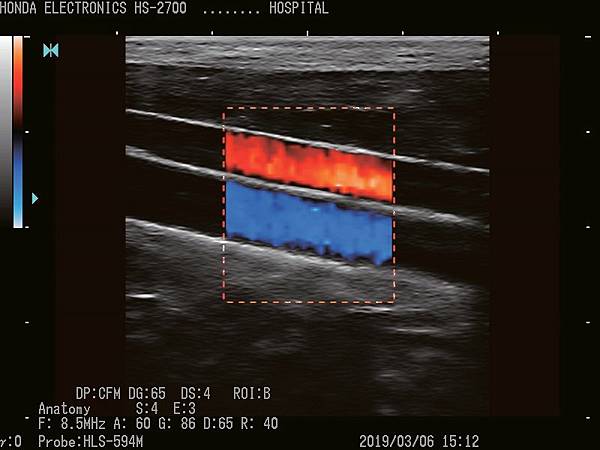 杜普勒動物用彩色超音波