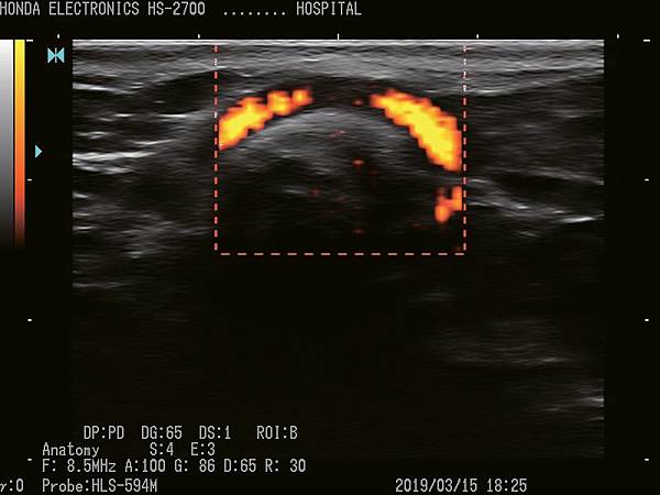 杜普勒動物用彩色超音波 杜普勒動物用彩色超音波