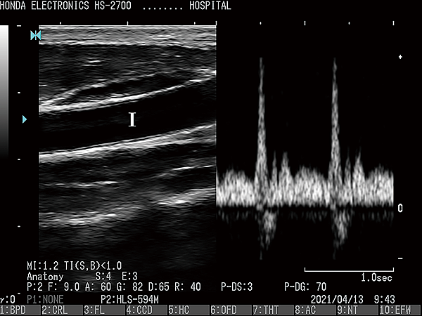 杜普勒動物用彩色超音波 杜普勒動物用彩色超音波