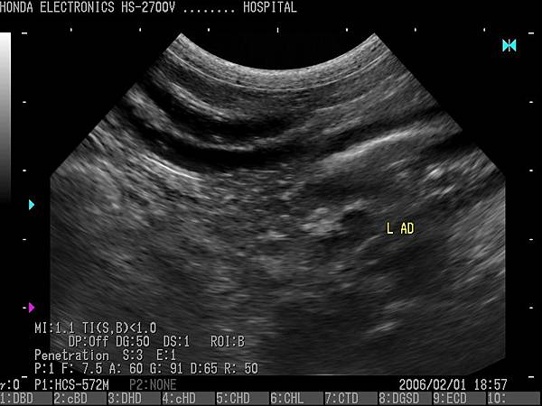 貴賓犬肝臟-1杜普勒動物用彩色超音波 貴賓犬肝臟-1杜普勒動物用彩色超音波