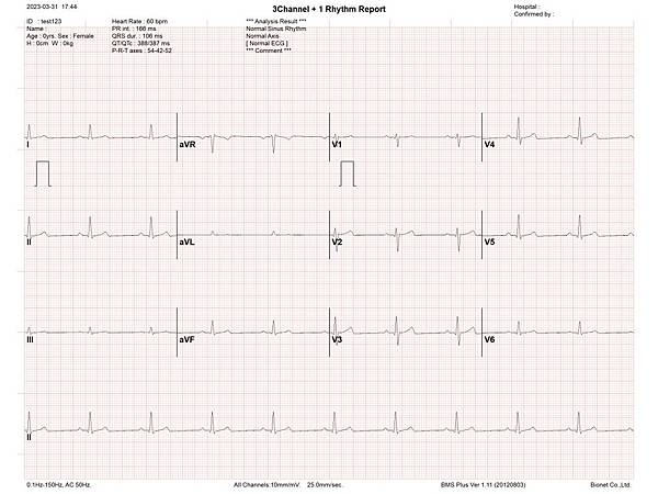 Bionet CardioTouch 3000 12導程心電 Bionet CardioTouch 3000 12導程心電