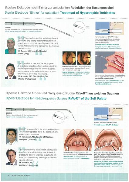 RF無線射頻電波ENT手術治療儀 RF無線射頻電波ENT手術治療儀