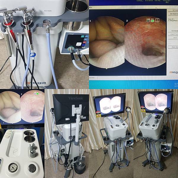 二手中古醫療儀器設備討論 二手中古醫療儀器設備討論