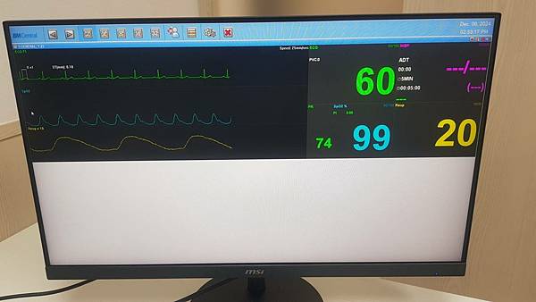 Bionet BM3血壓、血氧、心電圖三合一生理監視器 Bionet BM3血壓、血氧、心電圖三合一生理監視器