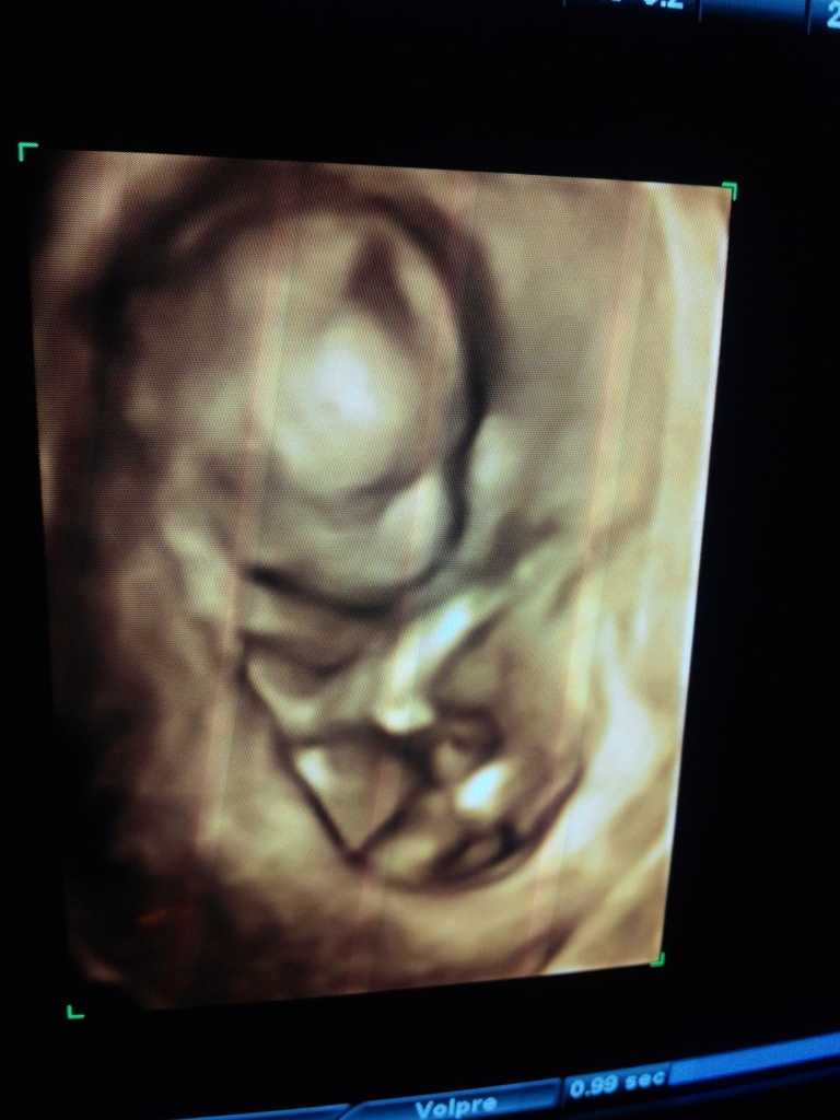 10854850_10206619200024158_6172832591819270899_o 10854850_10206619200024158_6172832591819270899_o