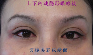 冠淳全上下內睫隱形眼線後RIMG4613.jpg