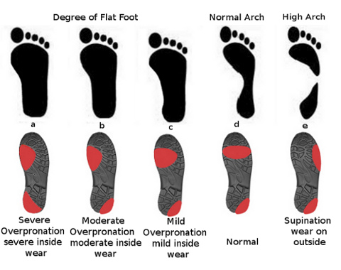 podiatry-london