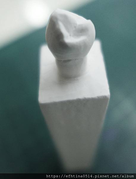 牙體型態雕刻-石膏