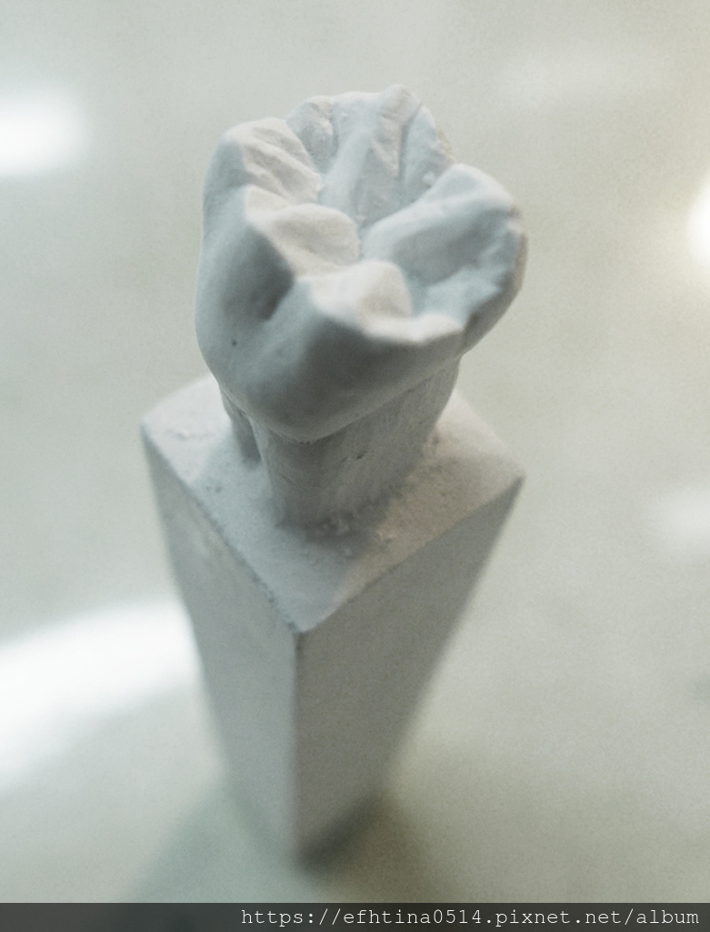 牙體型態雕刻-石膏