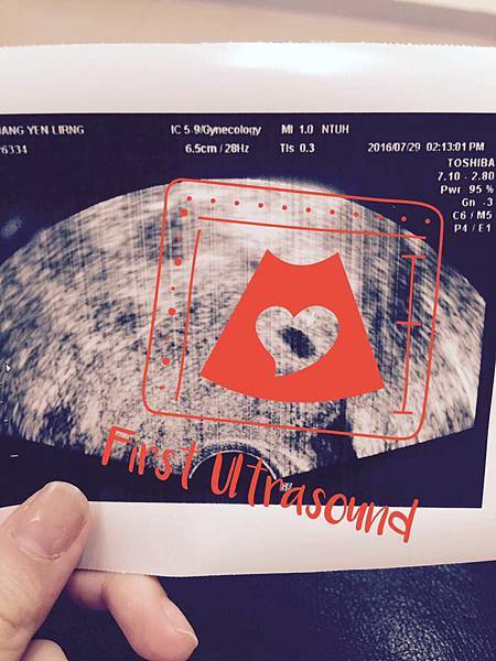 14192136_1275423732469174_8415010820703908749_n.jpg 14192136_1275423732469174_8415010820703908749_n.jpg