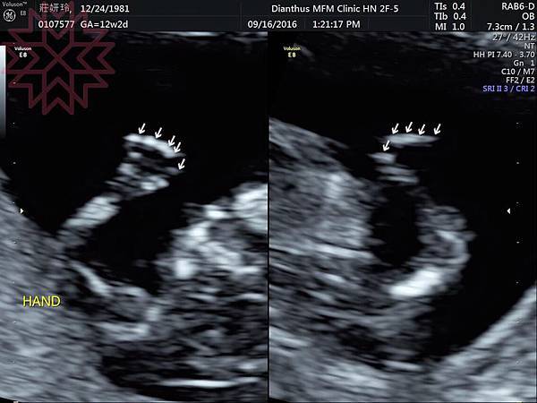 14344724_1287748871236660_4004589760028480613_n