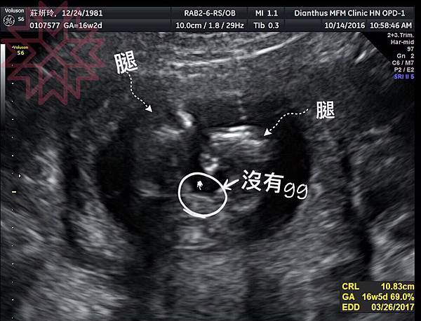 14991796_1340367959308084_4660017250049144680_n 14991796_1340367959308084_4660017250049144680_n