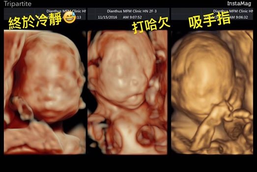 15055597_1340366155974931_1419307104705105128_n 15055597_1340366155974931_1419307104705105128_n