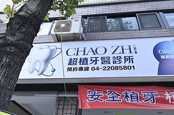 多顆缺牙長輩全口重建後，終於能安心大口吃人生！感謝超植牙醫吳