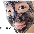 黑炭長_粉刺面膜_粉刺_黑頭_閉鎖性粉刺 (7).jpg
