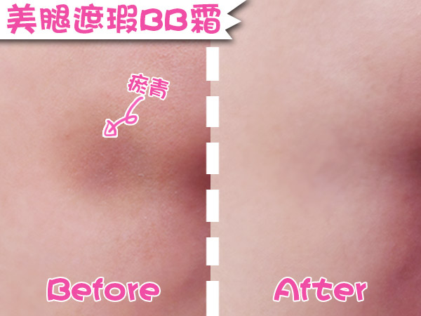 4_美腿遮瑕BB霜_3_膝蓋瘀青_B&A.jpg