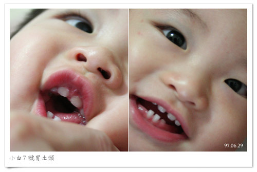 970629_teethpic.jpg