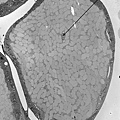 endosymbionts