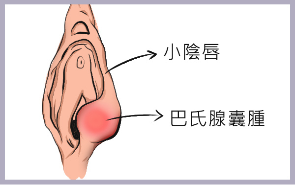 巴氏腺腺口位置示意图图片