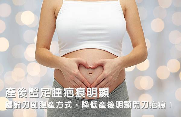 蟹足腫疤痕 蟹足腫疤痕