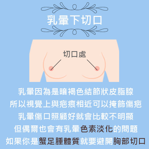 艾美零距離-乳暈下切口.jpg