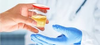 Image result for drug test