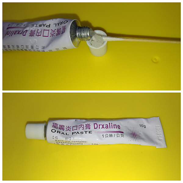 嘴破 口腔潰瘍藥物 使用心得介紹 Miss Mon 生活筆記 痞客邦