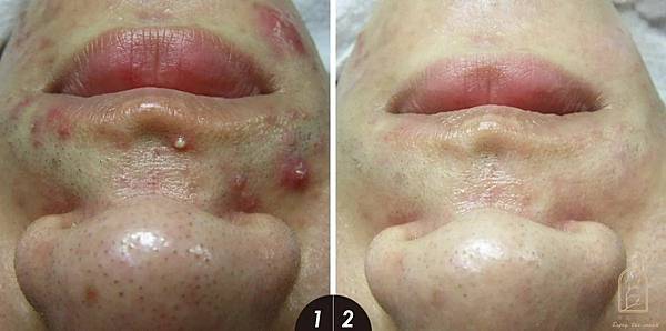 ［是真的嗎？］