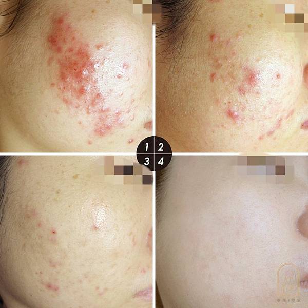 [你是否也有這樣的困擾 ]