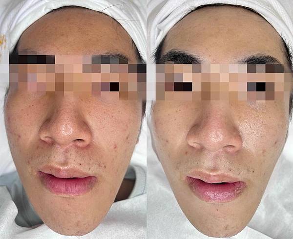 ［居家護理包］