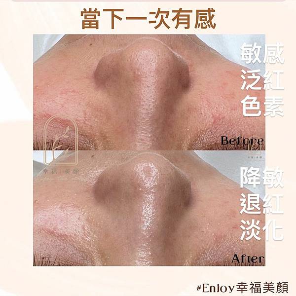 皮膚乾燥、脆弱、敏感如何保養