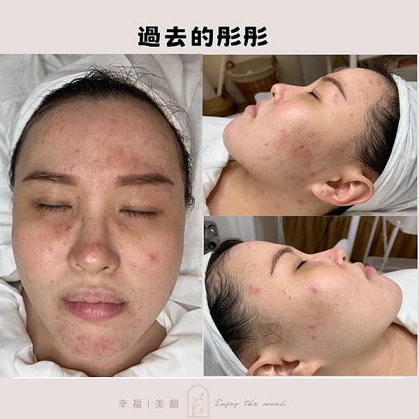 保養最終的目的就是要做到抗老抗衰