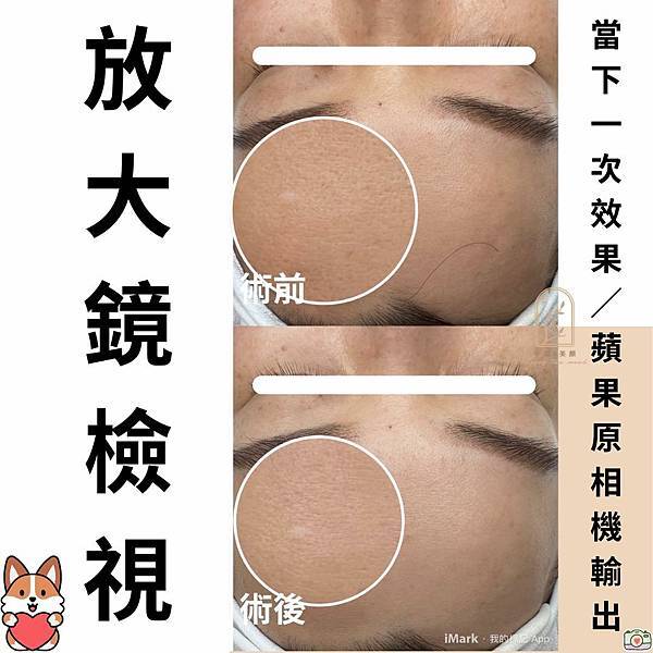 角質管理≠去角質