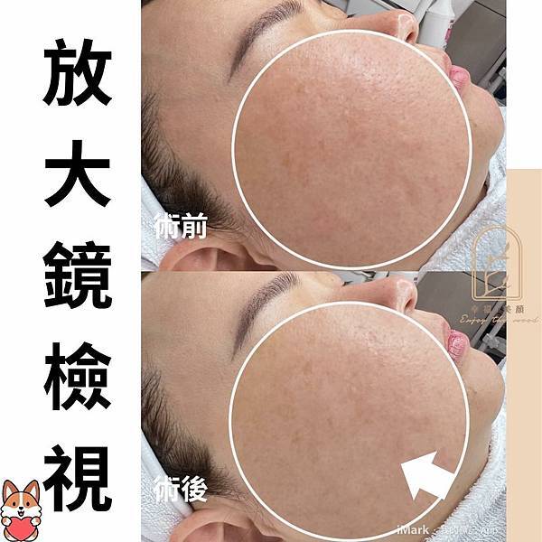 角質管理≠去角質