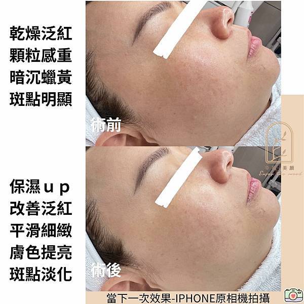 角質管理≠去角質