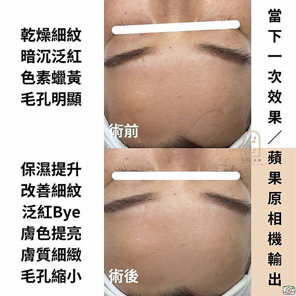 角質管理≠去角質