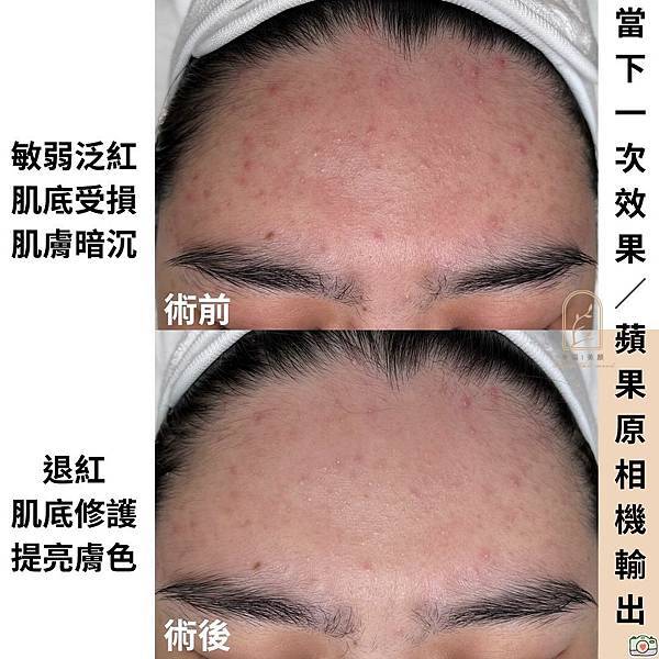 敏感肌也能保養