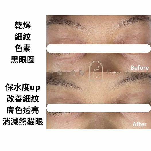 千萬不要讓眼睛透漏年齡!!!