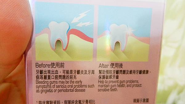 黑人專業護齦 抗敏感牙膏 (9).JPG