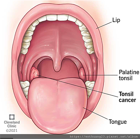 tonsil.png