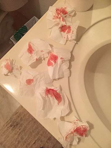 連續兩個月天天見血 懷孕初期出血 Amber的探索之旅 痞客邦