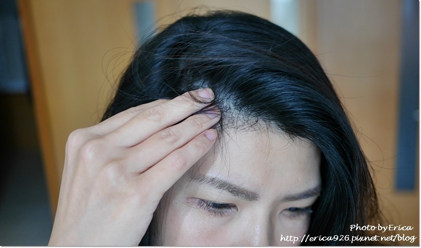 20191110 Scalp X头皮科研养发三部曲 (18).jpg