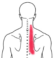 cervicogenic%20back%20pain