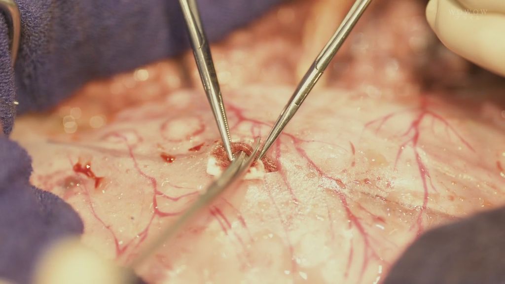 孤高的手術刀ep1 (4).JPG 孤高的手術刀ep1 (4).JPG